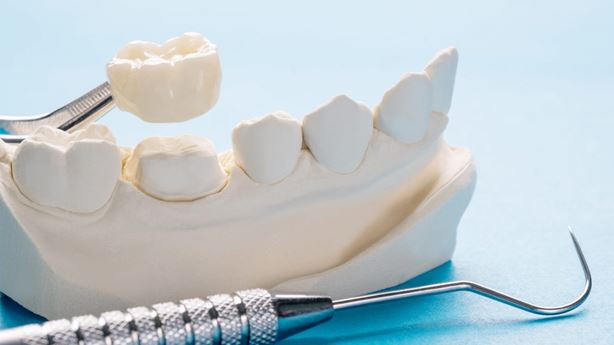 Is A Dental Crown Neccessary Tuart Hill Dental